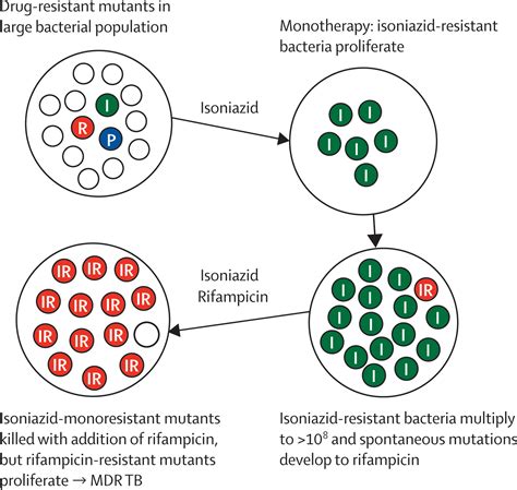 Multidrug Resistant And Extensively Drug Resistant Tuberculosis A