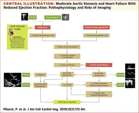 Moderate Aortic Stenosis And Heart Failure With Reduced Ejection