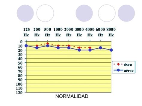 Acumetría Audiometría E Impedanciometría