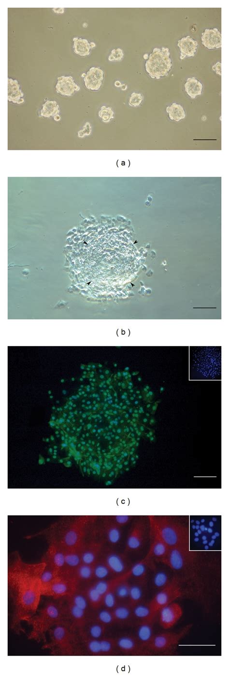 Sphere Culture Of Bovine Peripheral Corneal Endothelial Cells A