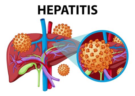 Página 4 Tecido Hepatico Imagens Download Grátis no Freepik