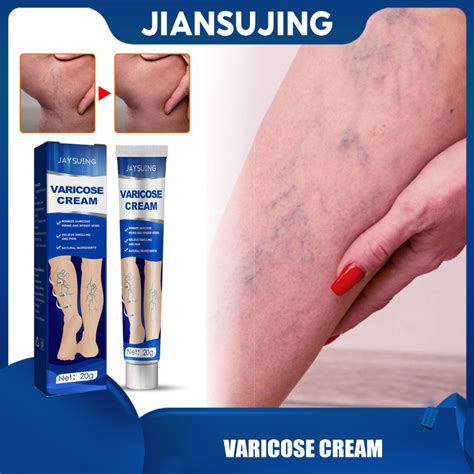 Jaysuing Varicose Vein Cream Herbal Vein Care Leg Cream Phlebitis Swelling Pain Relief Ointment