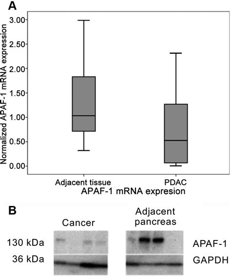 Epigenetic Regulation Of Apaf 1 Through Dna Methylation In Pancreatic