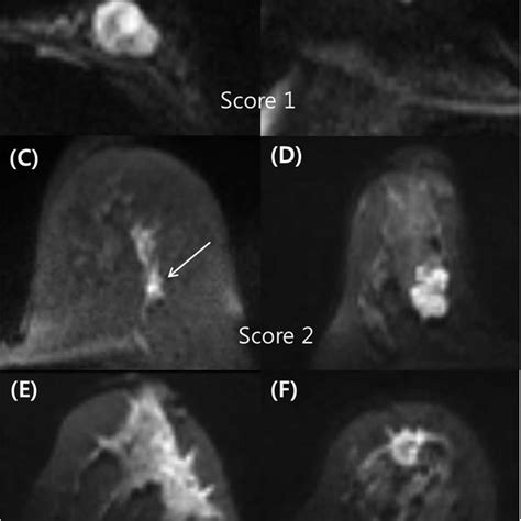 Examples Of Typical Cases For Each Type Of Score A A 43 Year Old Download Scientific Diagram