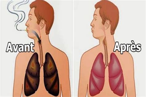 4 Aliments Magiques Pour Nettoyer Les Poumons Des Fumeurs