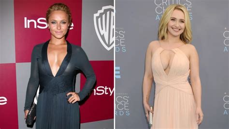 Hayden Panettiere Lips: Plastic Surgery, Before And After 2024