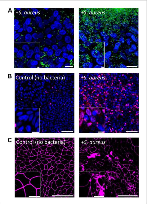 Figure 4 From In Vitro Co Culture Of Clostridium Scindens With Primary Human Colonic Epithelium