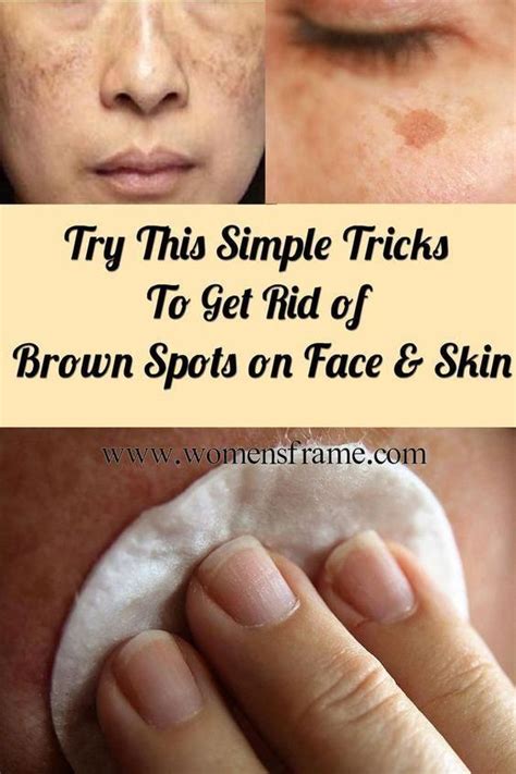 Every Woman Should Know These Brown Spots On Face Brown Spots Removal Brown Spots On Skin