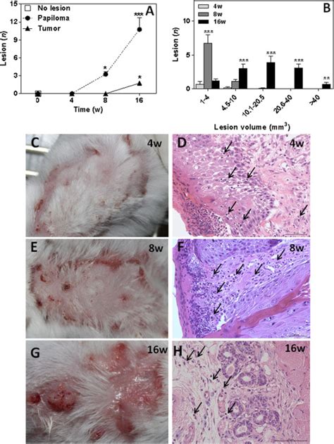 Squamous Cell Carcinoma Induced By Dmbatpa In Mice Scc Mice Were Download Scientific Diagram