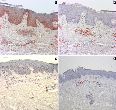 Human Hsp60 Is Expressed In The Skin A Hsp60 Staining In An Active