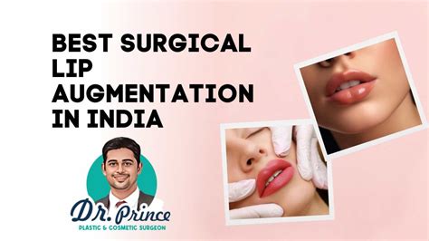 Best Surgical Lip Augmentation in India - topplasticsurgery