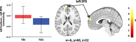 Seed‐to‐voxel Functional Connectivity Analyses In The Exploration Download Scientific Diagram