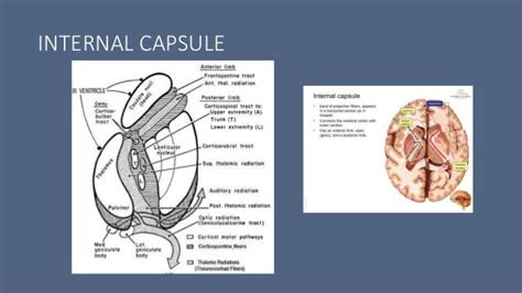 Stroke syndromes