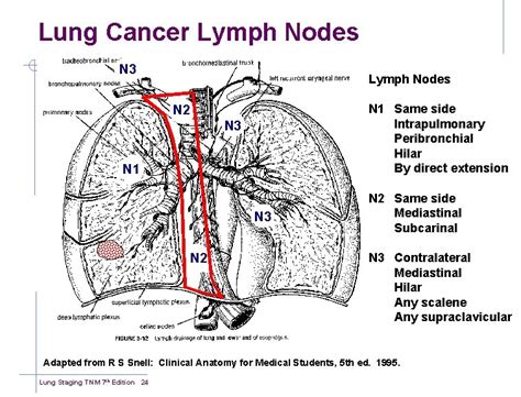 TNM Staging of Lung Cancer 7 th Edition