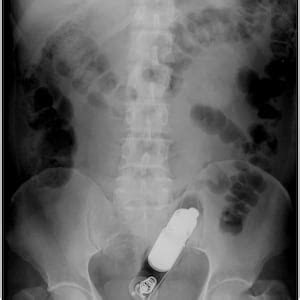 Authentic Real Sex Toy Dildo Xrays Lot Of Etsy