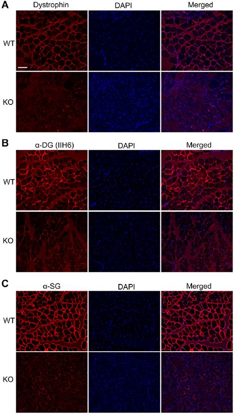 Disruption Of Dystrophin Expression In The Skeletal Muscle Of Dmd Ko