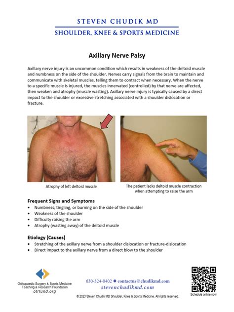 Axillary Nerve Palsy | Download Free PDF | Shoulder | Clinical Medicine