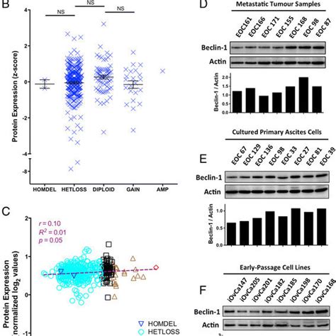 Beclin 1 Protein Expression Is Maintained In High Grade Serous Ovarian