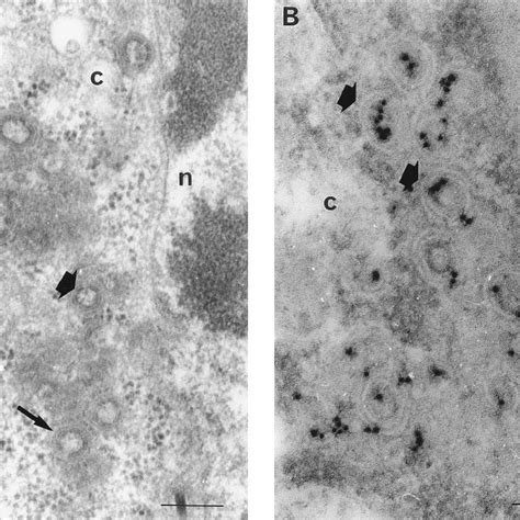 Thin Section Electron Microscopy Of Sf9 Cells Infected For 48 H A