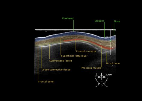 fh  cutaneous