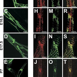 Expression Of Lymphatic Endothelial Markers During Formation Of