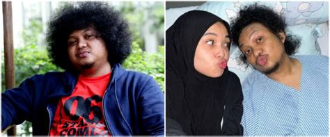 Komika Babe Cabita Meninggal Di Usia Tahun Usai Berjuang Lawan Penyakit Langka