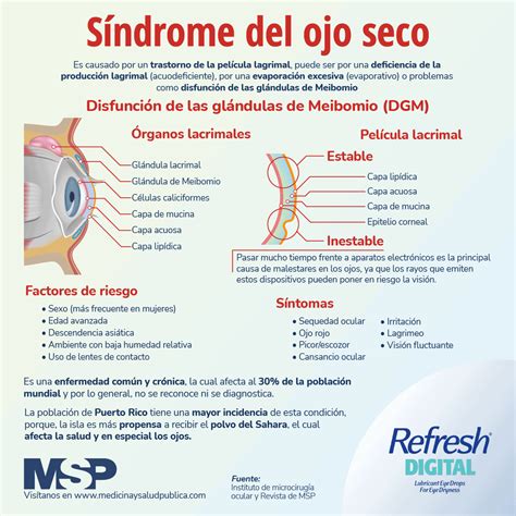 Enfermedad Del Ojo Seco Infografías