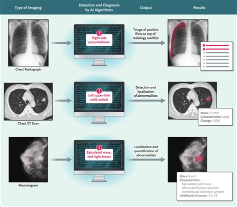 The Current And Future State Of AI Interpretation Of Medical Images NEJM