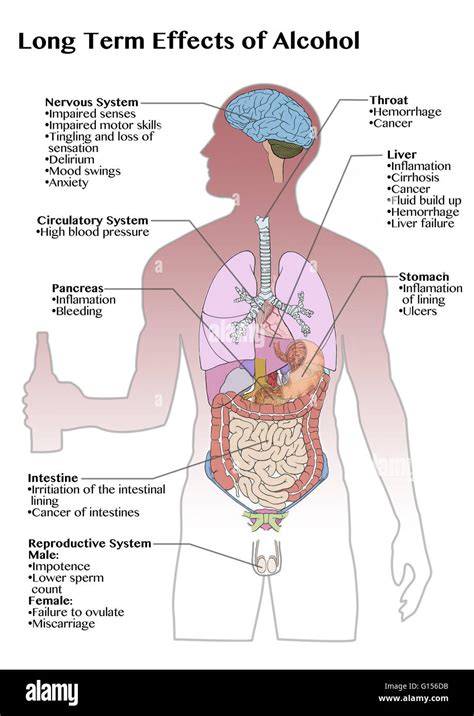 Diagram Showing The Long Term Effects Of Excess Alcohol Consumption