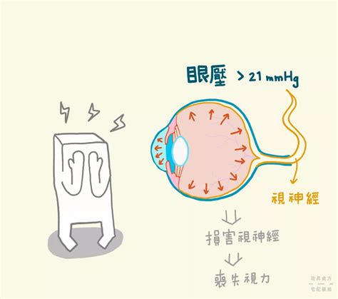 青光眼太晚發現恐失明，8類高危險群注意這些症狀！