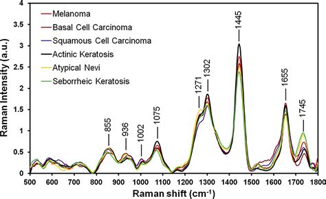 Using Raman Spectroscopy To Detect And Diagnose Skin Cancer In Vivo