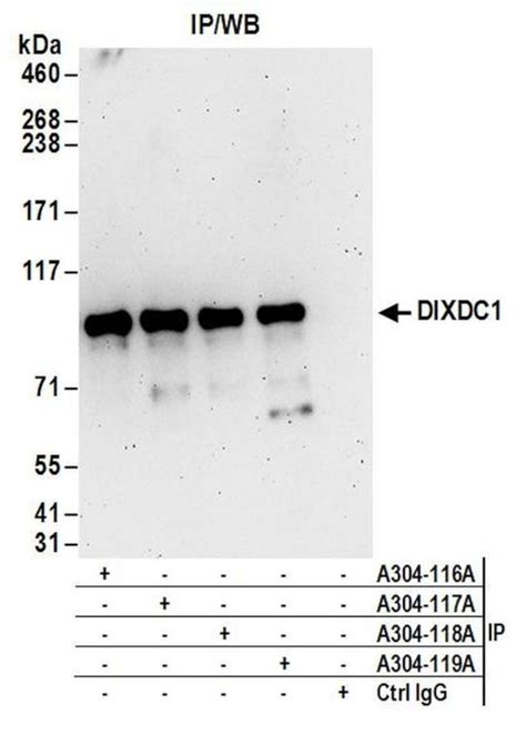 Dixdc1 Polyclonal Antibody A304 118a