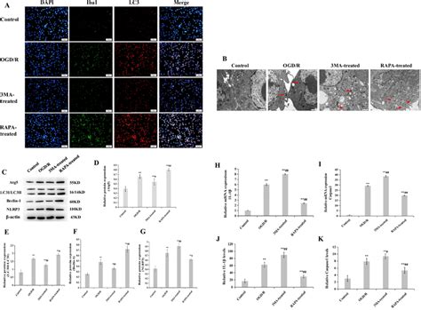 Autophagy And Inflammatory In Microglia Induced By OGD R A The