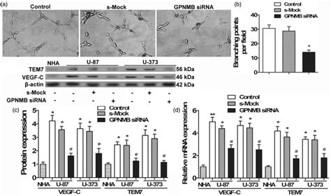 Suppression Of Gpnmb Decreases Glioma Angiogenesis U 87 Mg And U 373