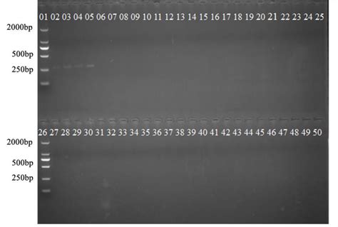 Frontiers Development Of Real Time Pcr And Droplet Digital Pcr Based