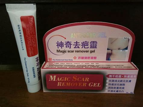 Authentic Magic Scar Remover Gel 40g Lazada Ph