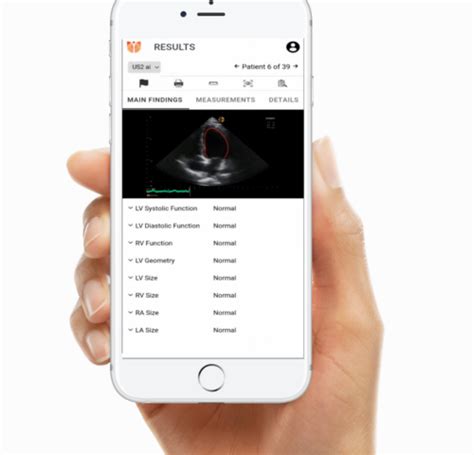 Biomarkers And Ai For The Transformation Of Heart Failure Diagnosis