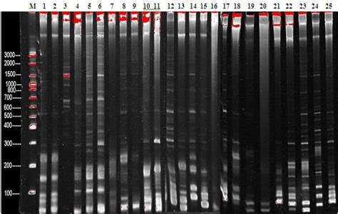 Figur Gel Electrophoresis Of Marker Microsatellite M Dna Size