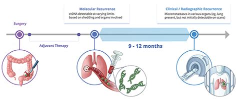 Utility and Debate of Liquid Biopsy Assays in Surveillance Setting