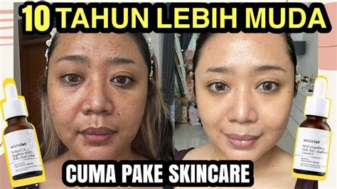 4 Serum Retinol Murah Dan Bagus Untuk Usia 50 Tahun Bikin Wajah Awet