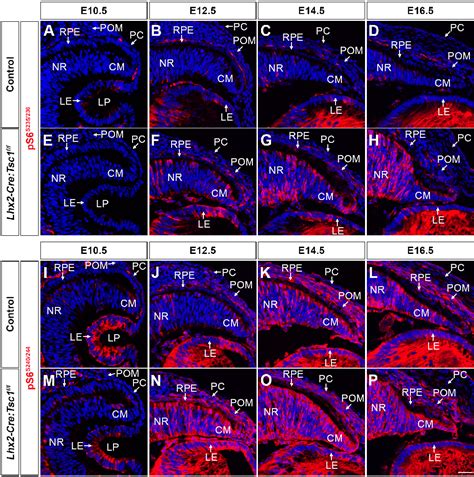 Figure 4 From A Novel Mouse Model Of Anterior Segment Dysgenesis ASD