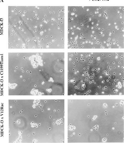 Figure 1 From Matrix Dependent Tiam 1 Rac Signaling In Epithelial