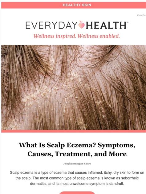 Lifescript What Is Scalp Eczema Symptoms Causes Treatment And More