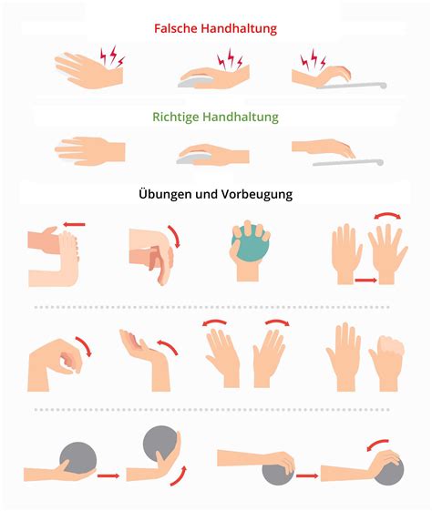 Karpaltunnelsyndrom Ursachen Symptome Und Behandlung