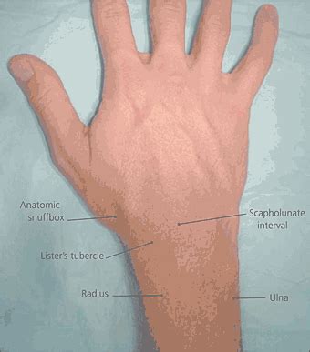 Listers Tubercle Palpation