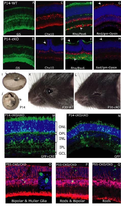 Postnatal Retinal Development In The Sfrs1 CKO Mouse A H