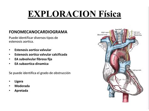 Estenosis Aortica