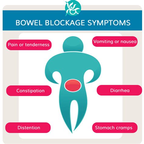 how to treat a bowel blockage at home