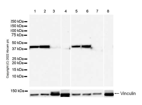 Anti Aldolase C N terminal 抗体 EPR26895 52 ab302952