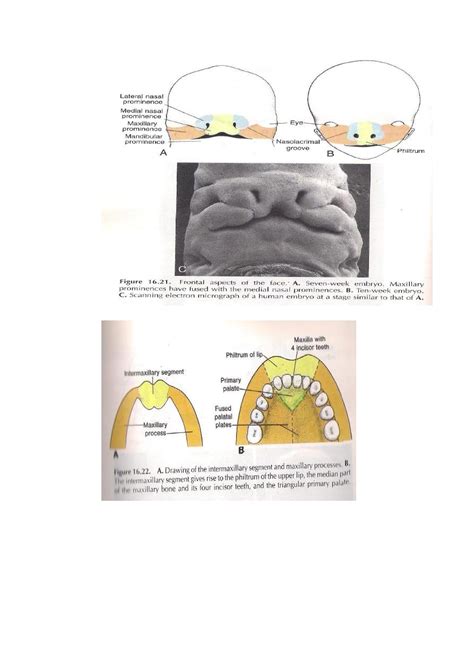 Midgut Embryology Pdf Profdr Alhubaity Muhadharaty